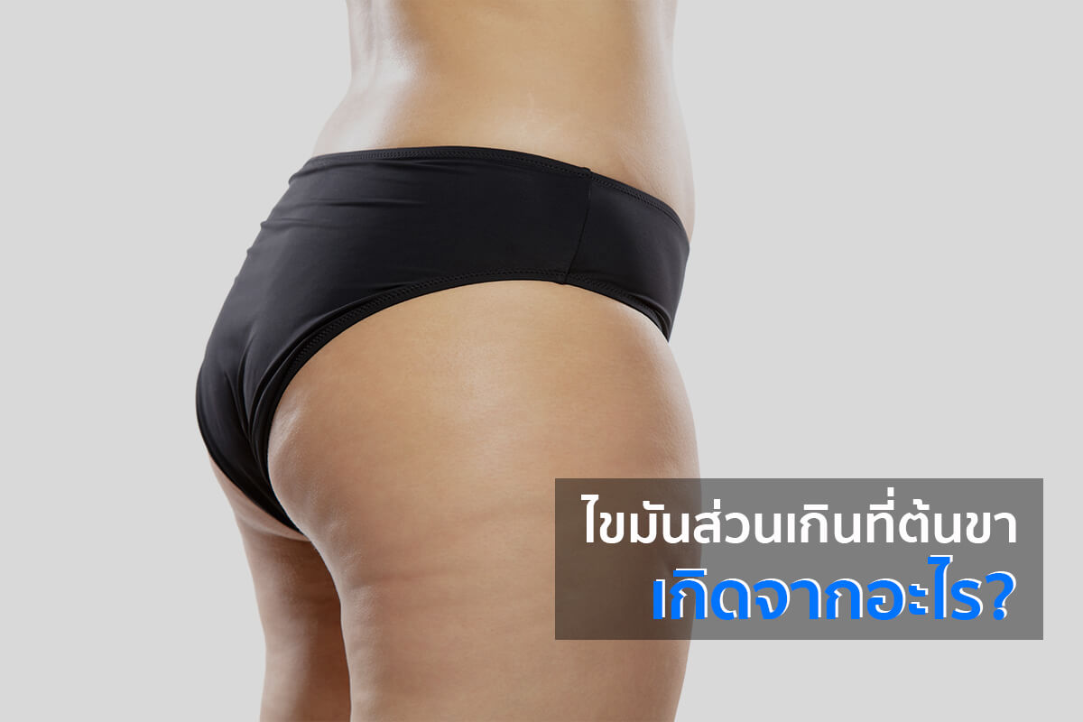 วิธีลดต้นขา