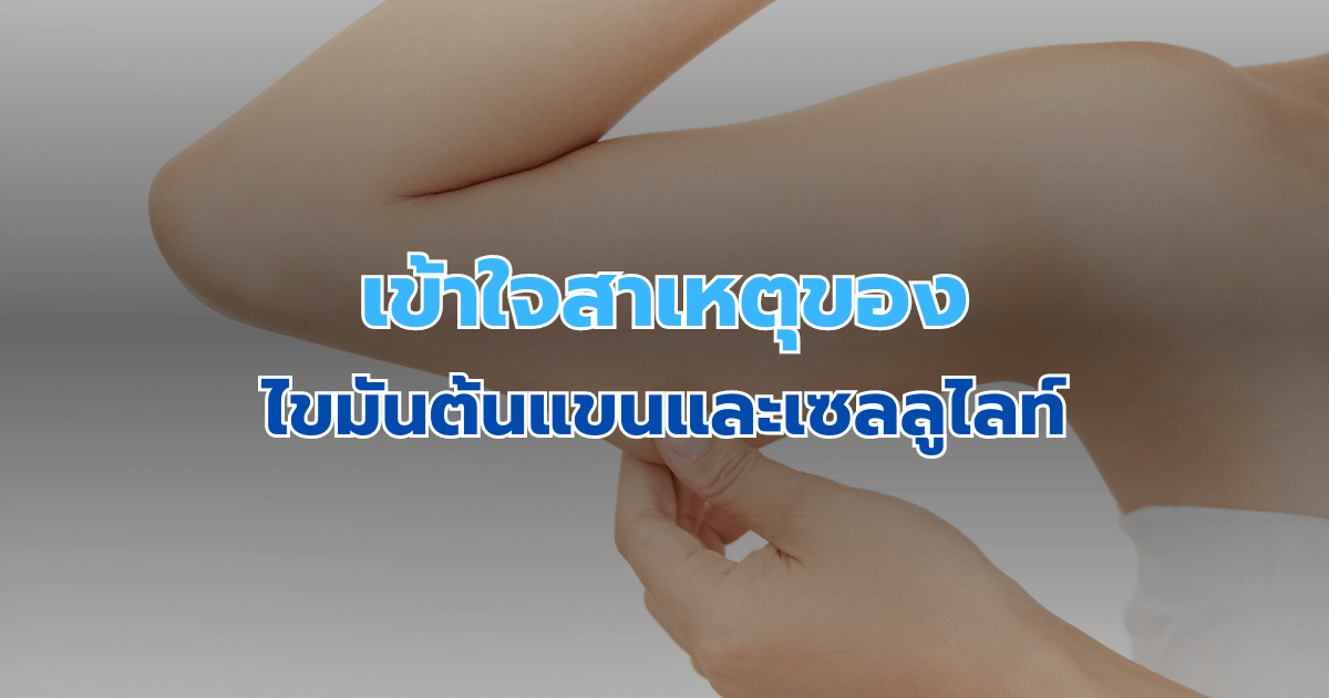 เข้าใจสาเหตุของไขมันต้นแขนและเซลลูไลท์