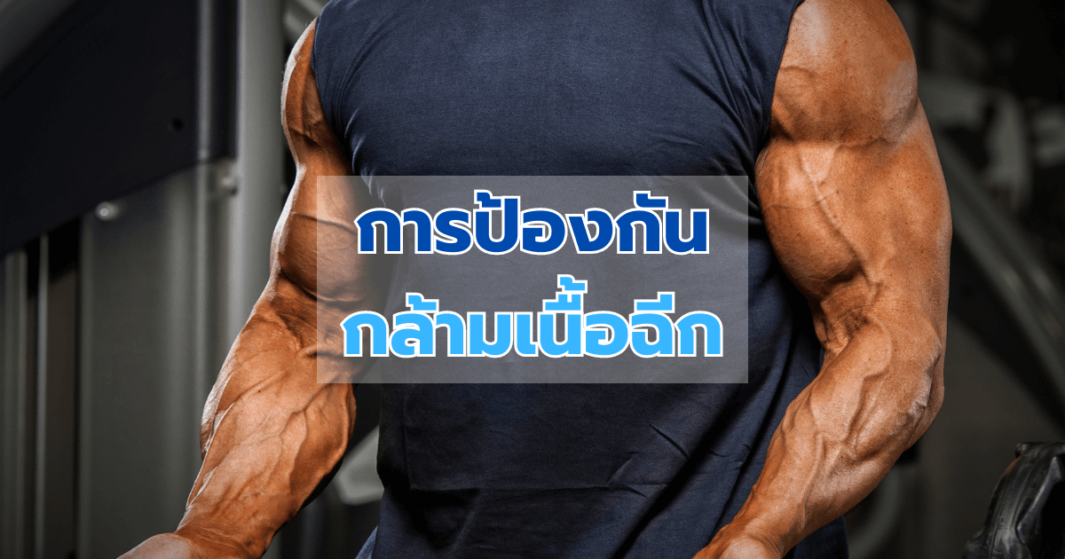 การป้องกันกล้ามเนื้อฉีก