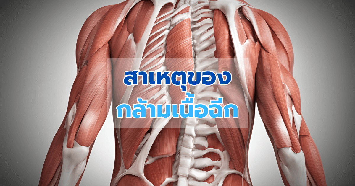 สาเหตุของกล้ามเนื้อฉีก